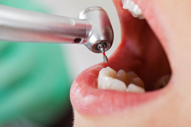 Best Emergency Treatment for Oral Infections in Melwood, MD